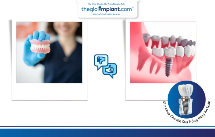 Thế Giới Implant