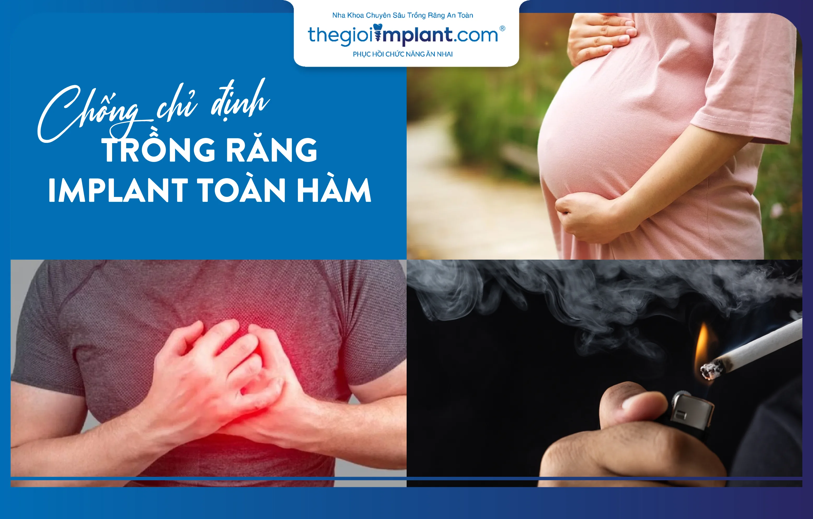 Trường hợp chống chỉ định trồng răng Implant toàn hàm