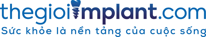 Thế Giới Implant