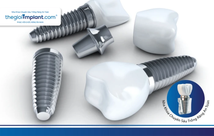 Thế Giới Implant