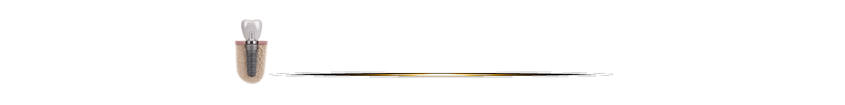 Thế Giới Implant