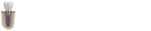 Thế Giới Implant