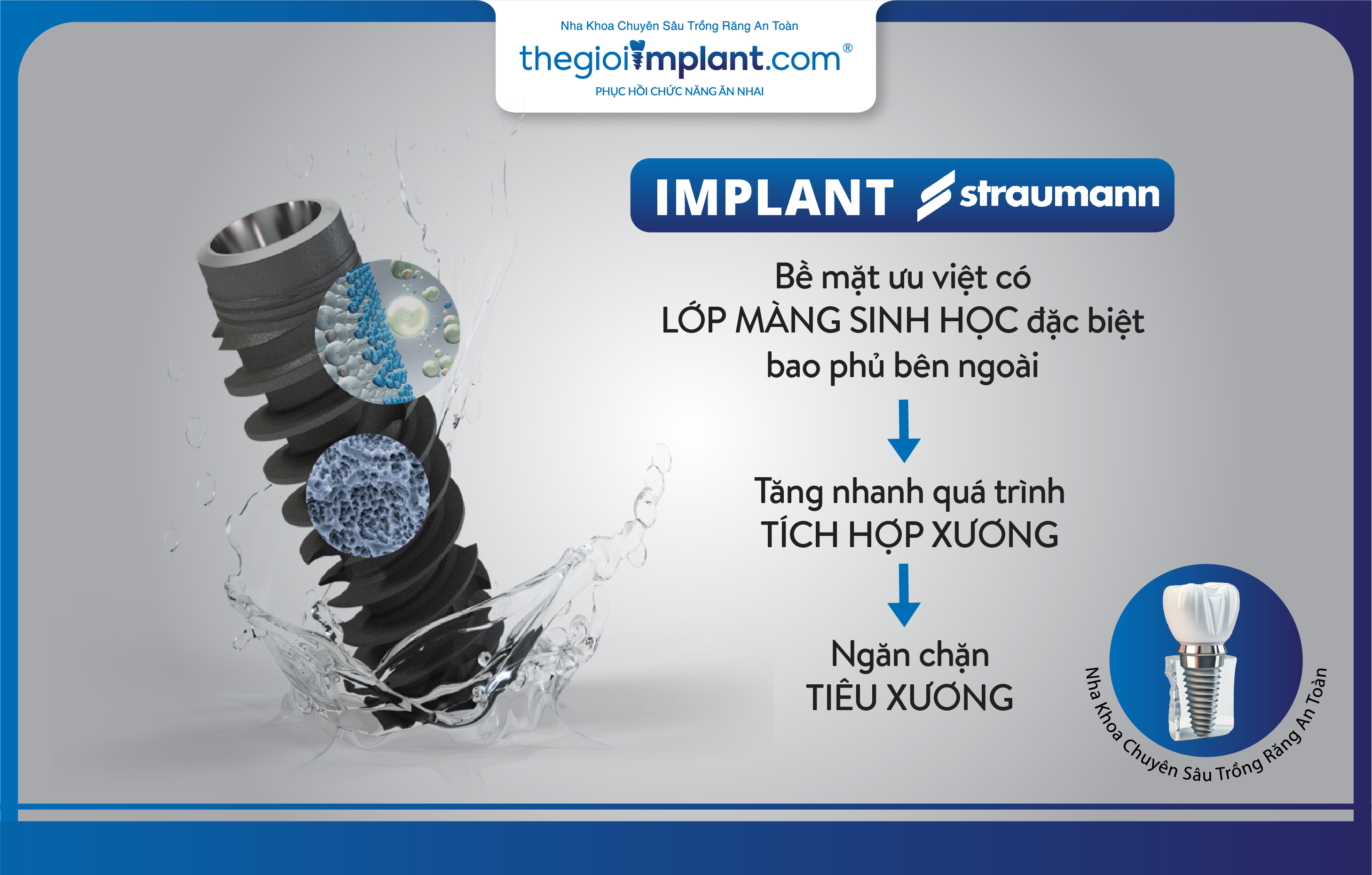 Implant Straumann