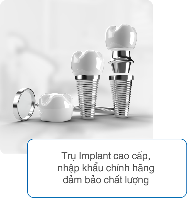 Thế Giới Implant Homepage