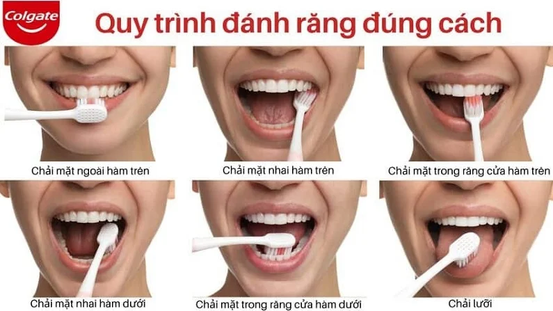 Thế Giới Implant