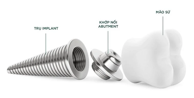 Thế Giới Implant