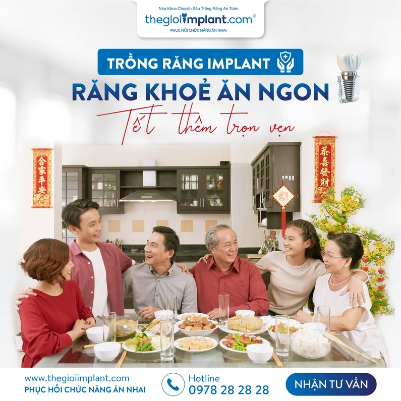 Thế Giới Implant