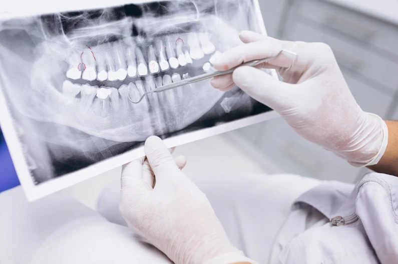 Thế Giới Implant
