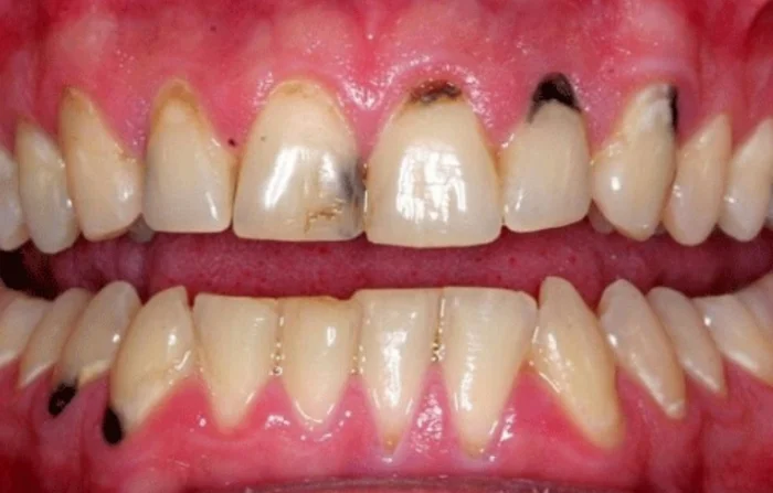 Thế Giới Implant