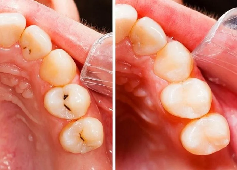 Thế Giới Implant