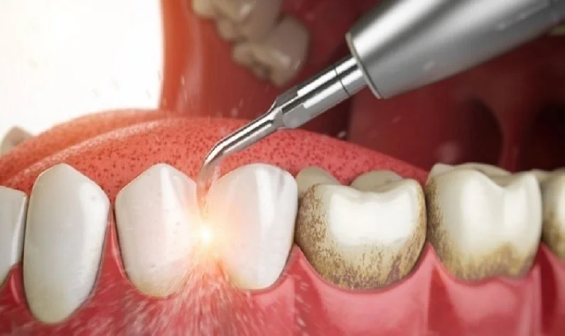 Thế Giới Implant