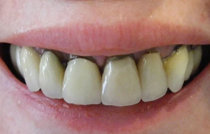 Thế Giới Implant