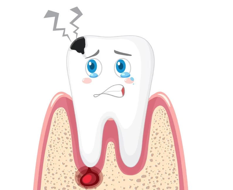 Thế Giới Implant