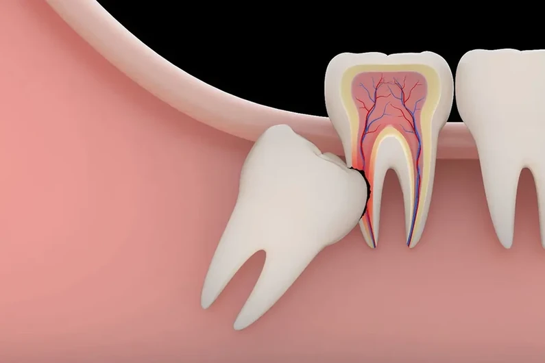 Thế Giới Implant