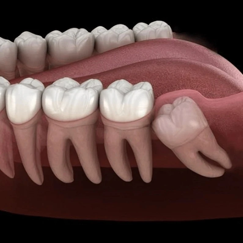 Thế Giới Implant