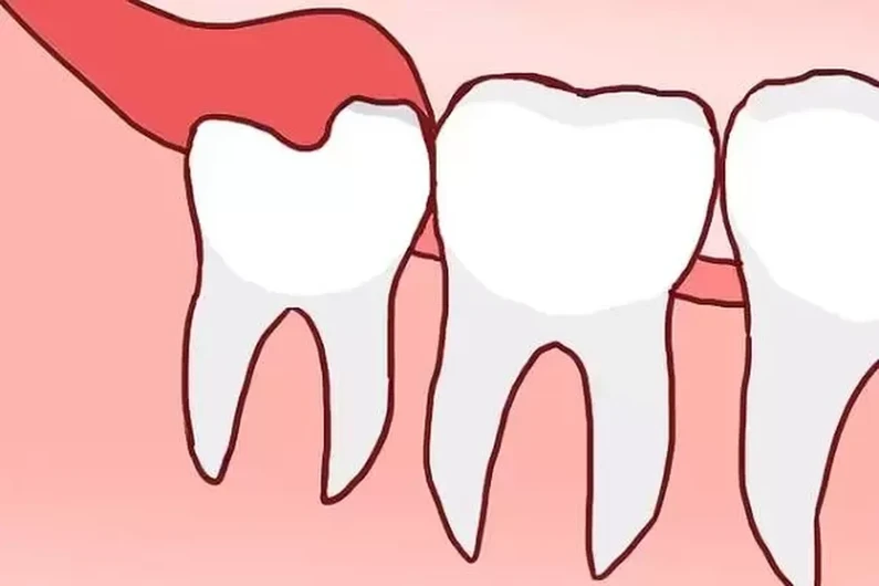 Thế Giới Implant