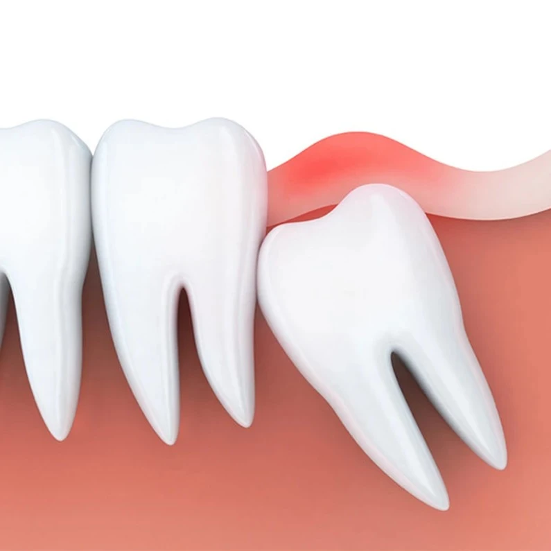Thế Giới Implant