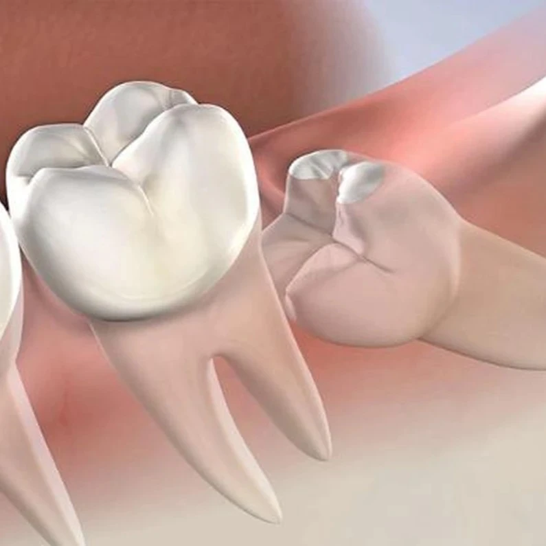 Thế Giới Implant