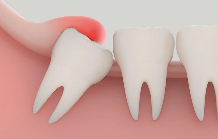 Thế Giới Implant