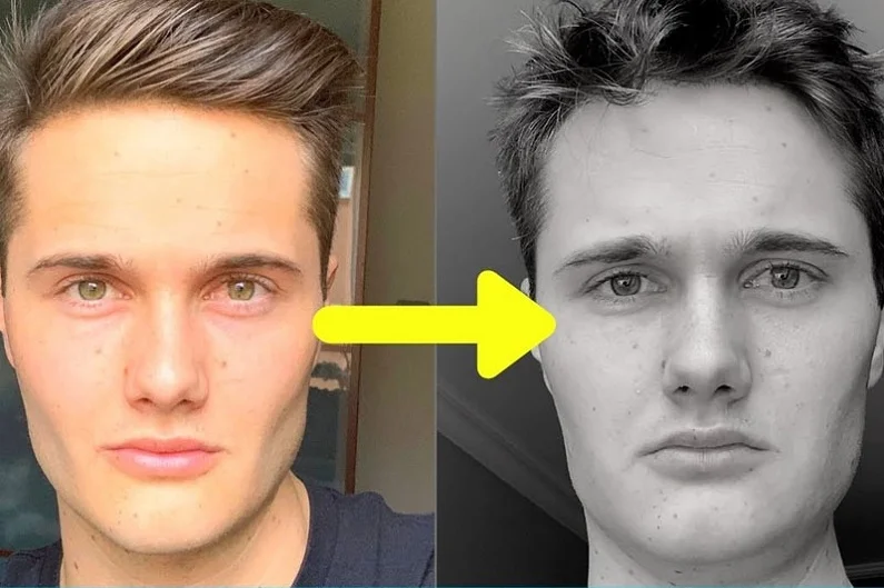 Thế Giới Implant