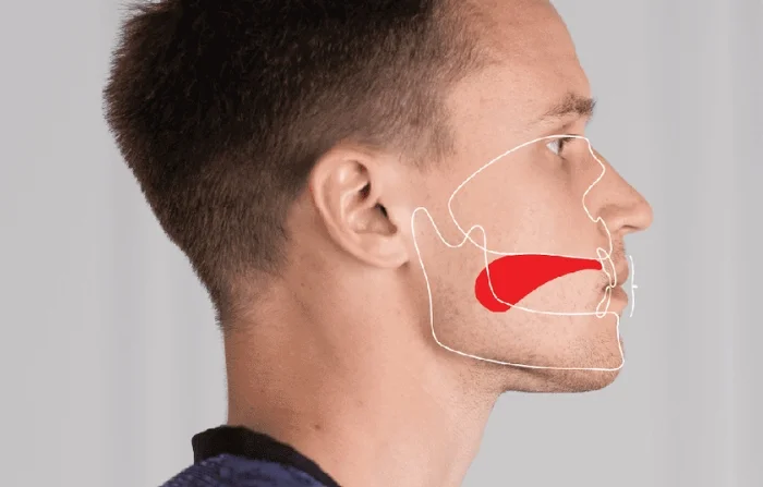 Thế Giới Implant