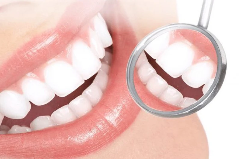 Thế Giới Implant