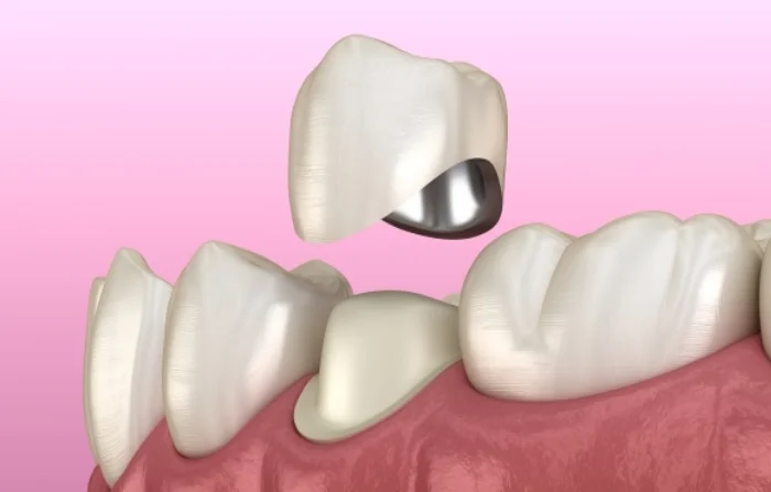 Thế Giới Implant