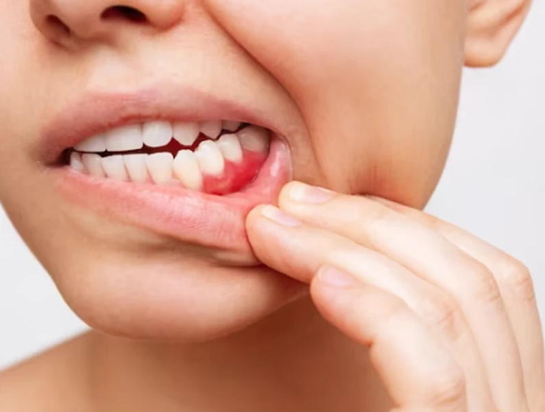 Thế Giới Implant