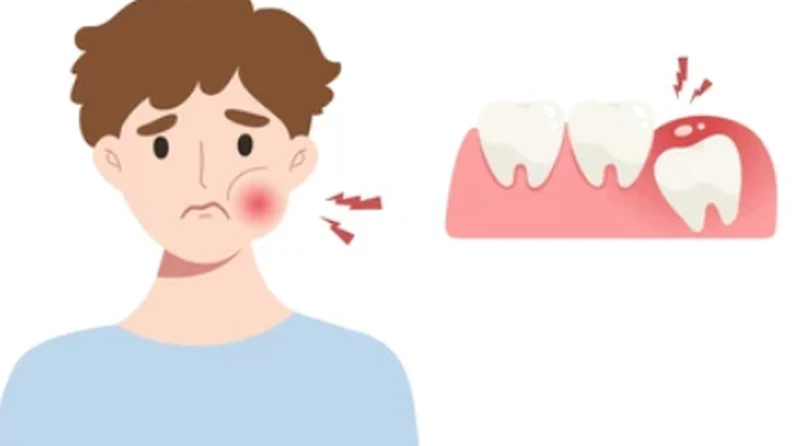 Thế Giới Implant