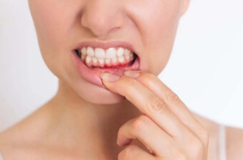Thế Giới Implant