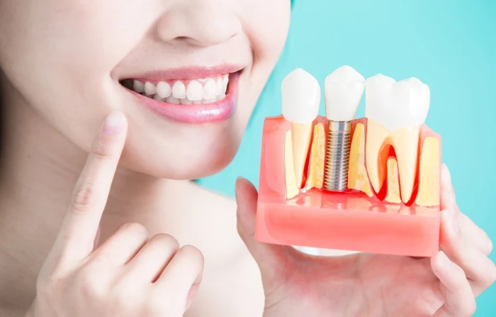 Thế Giới Implant