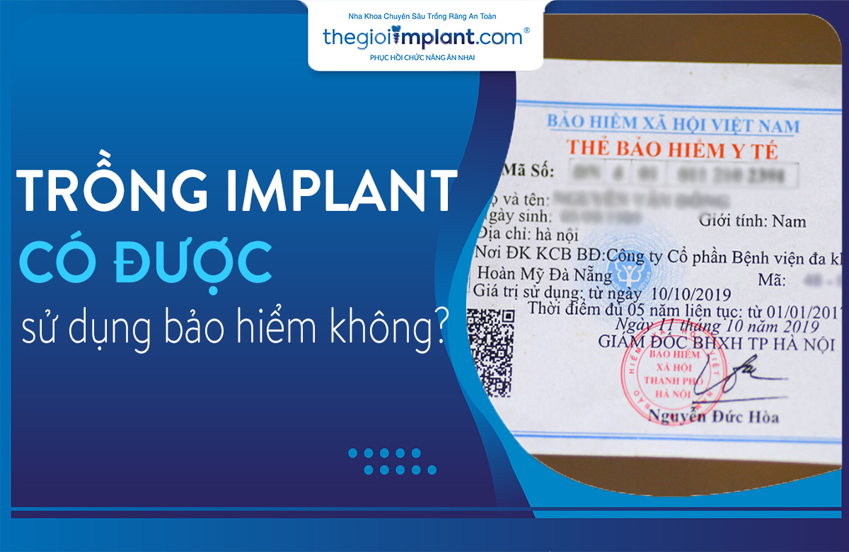 trồng răng implant có được bảo hiểm không