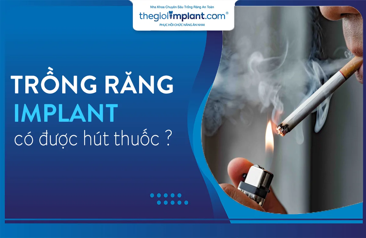trồng răng implant có được hút thuốc không