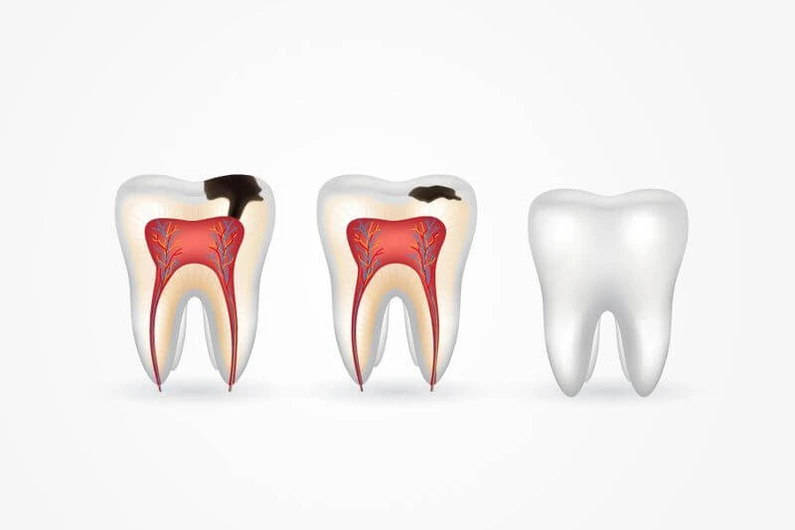 Thế Giới Implant