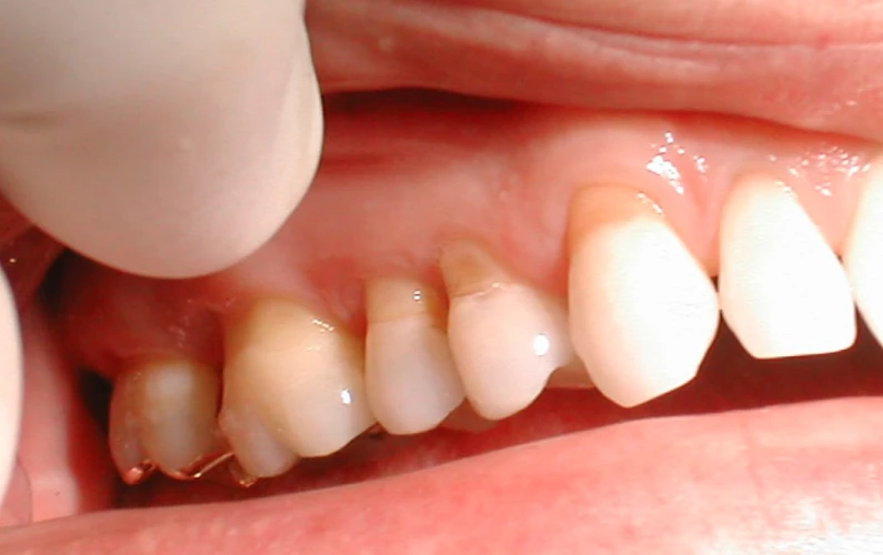 Thế Giới Implant