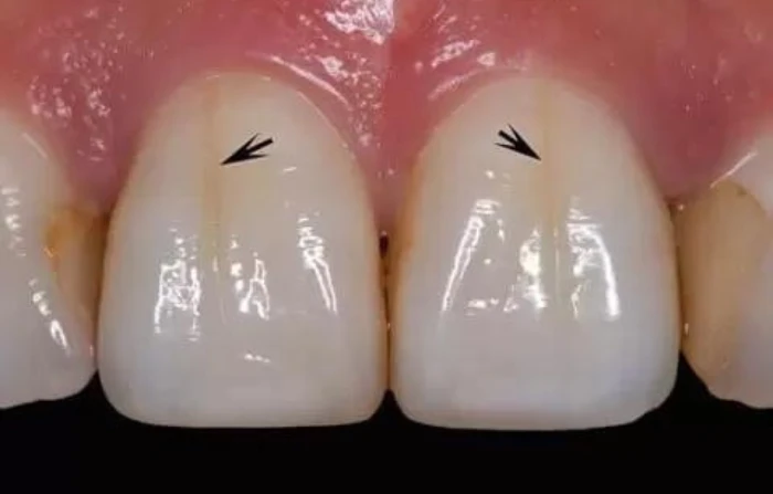 Thế Giới Implant