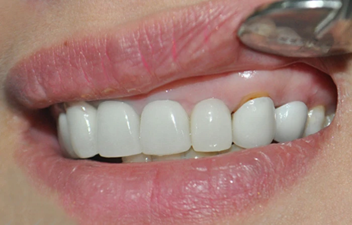 Thế Giới Implant