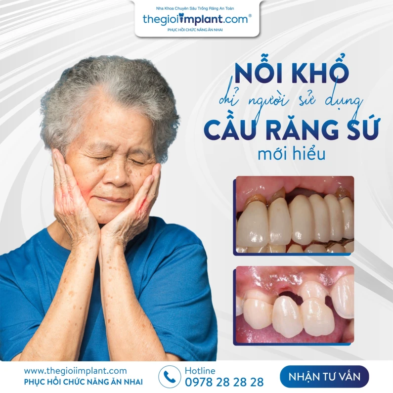 Thế Giới Implant