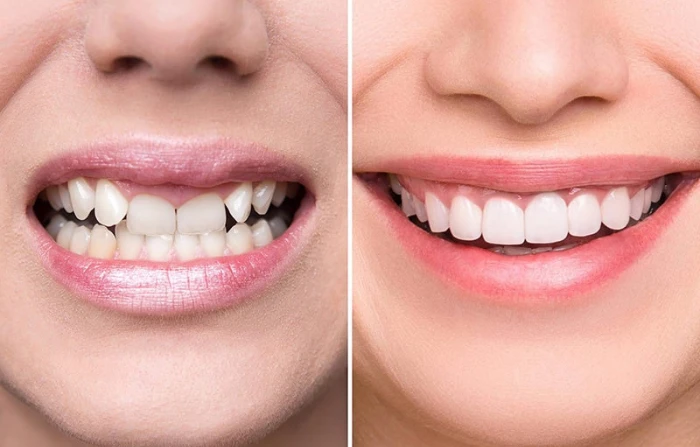 Thế Giới Implant