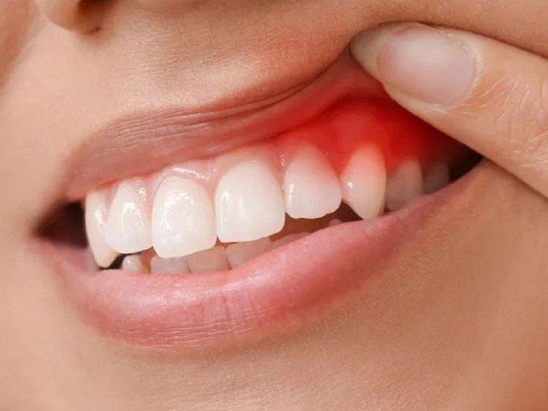 Thế Giới Implant