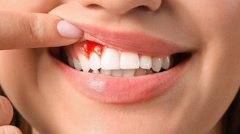 Thế Giới Implant