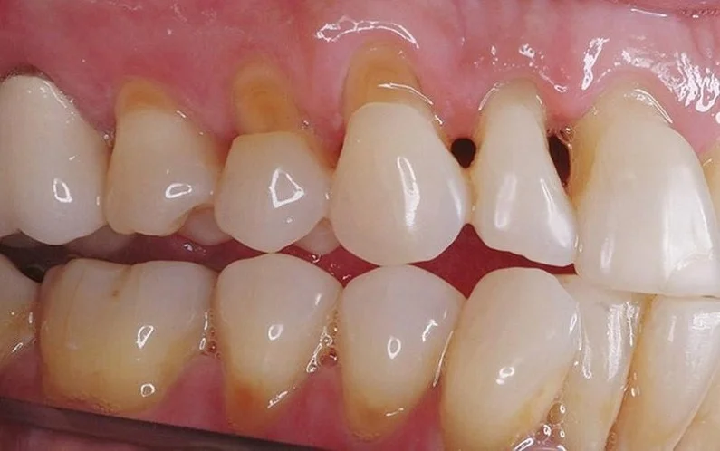 Thế Giới Implant