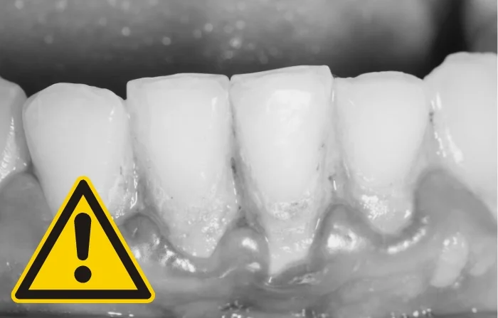 Thế Giới Implant