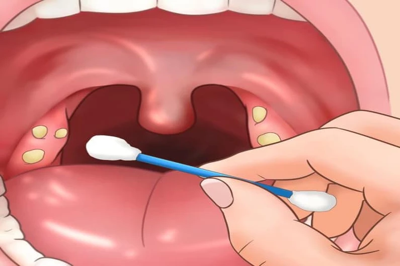 Thế Giới Implant