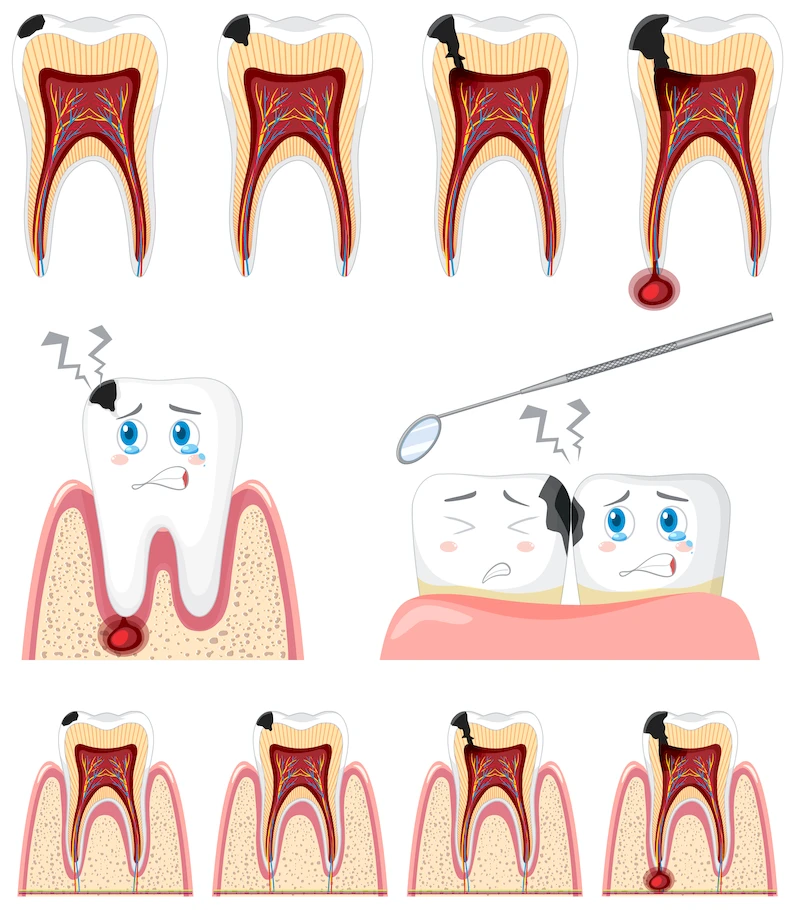 Thế Giới Implant