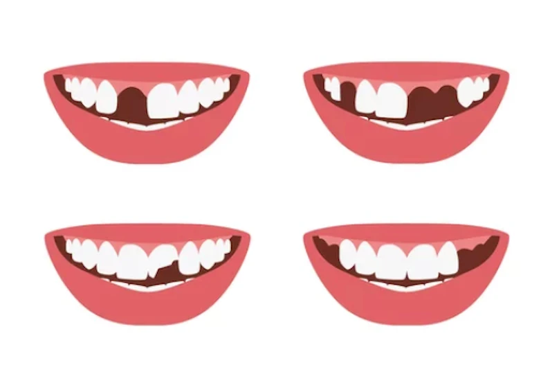 Thế Giới Implant