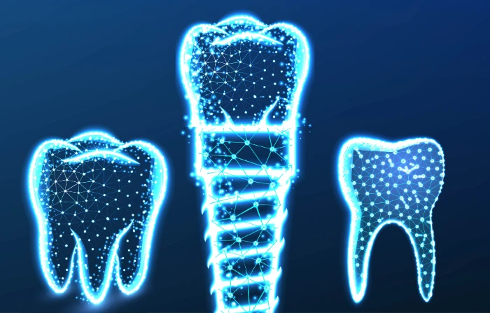 Có nên trồng răng Implant để phòng ngừa tiêu xương răng?