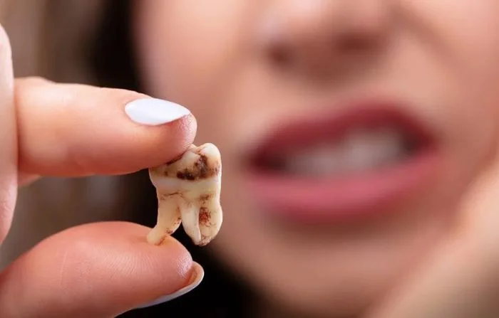 Thế Giới Implant