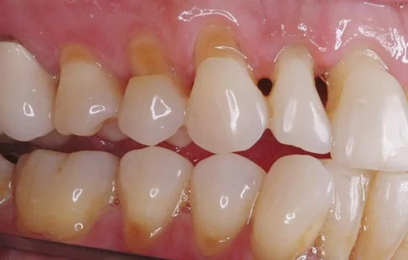 Thế Giới Implant