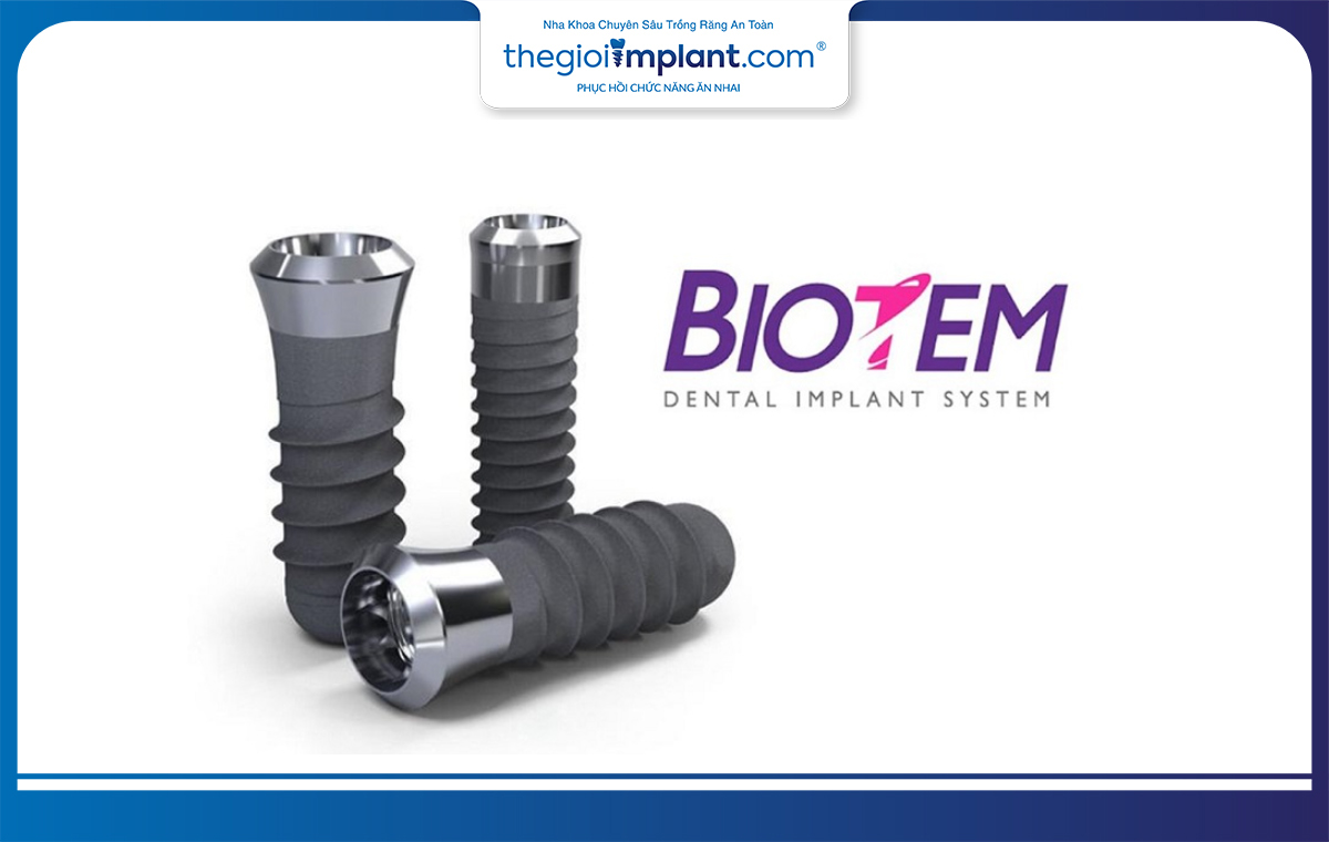 Trụ implant Biotem có tuổi thọ lâu dài